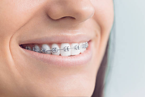 Best Teeth Whitening  in Wymore, NE